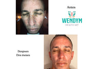 Mentoría Glowlogy – Rosácea